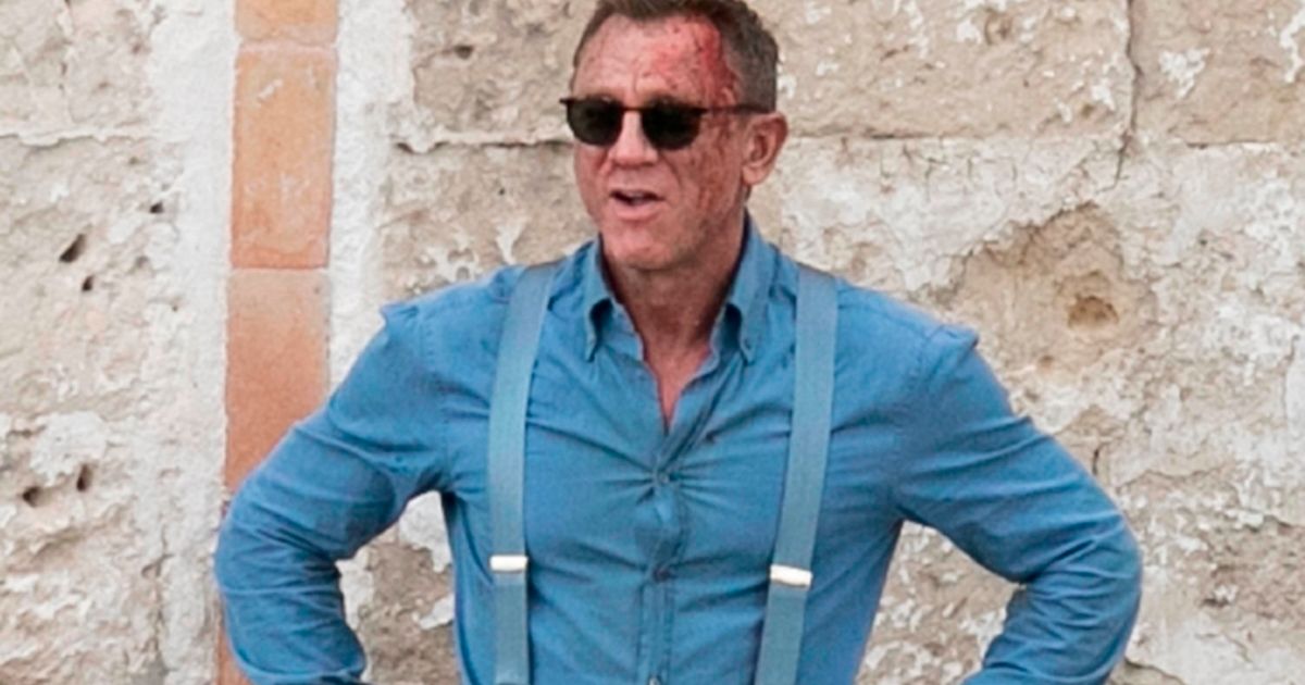 Daniel Craig spotted in bloodied, bruised look